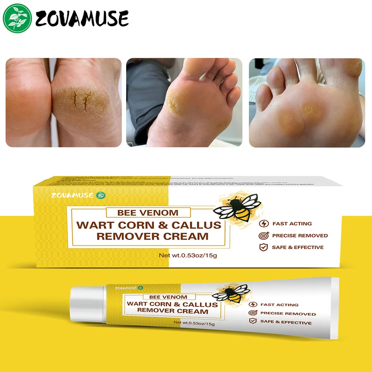 Callus Softening Cream for Dry, Cracked Skin