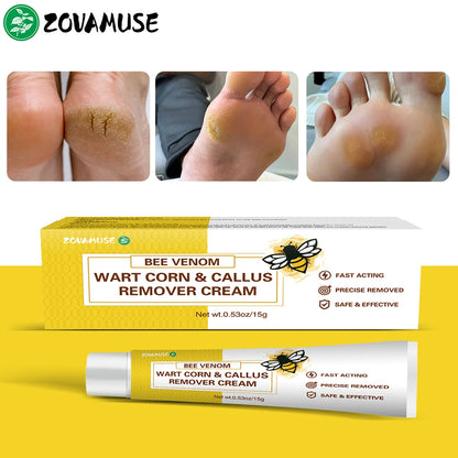 Callus Softening Cream for Dry, Cracked Skin