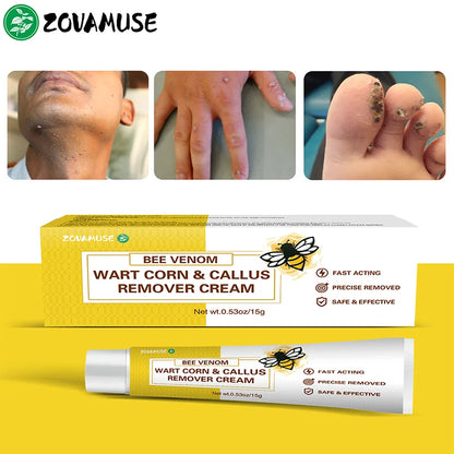 Wart Smoothing Cream for Rough, Thickened Skin