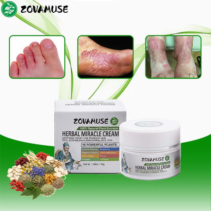 Athlete's Foot Relief Cream for Itchy, Burning Skin