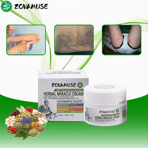 Ringworm Relief Cream for Itchy, Irritated Skin