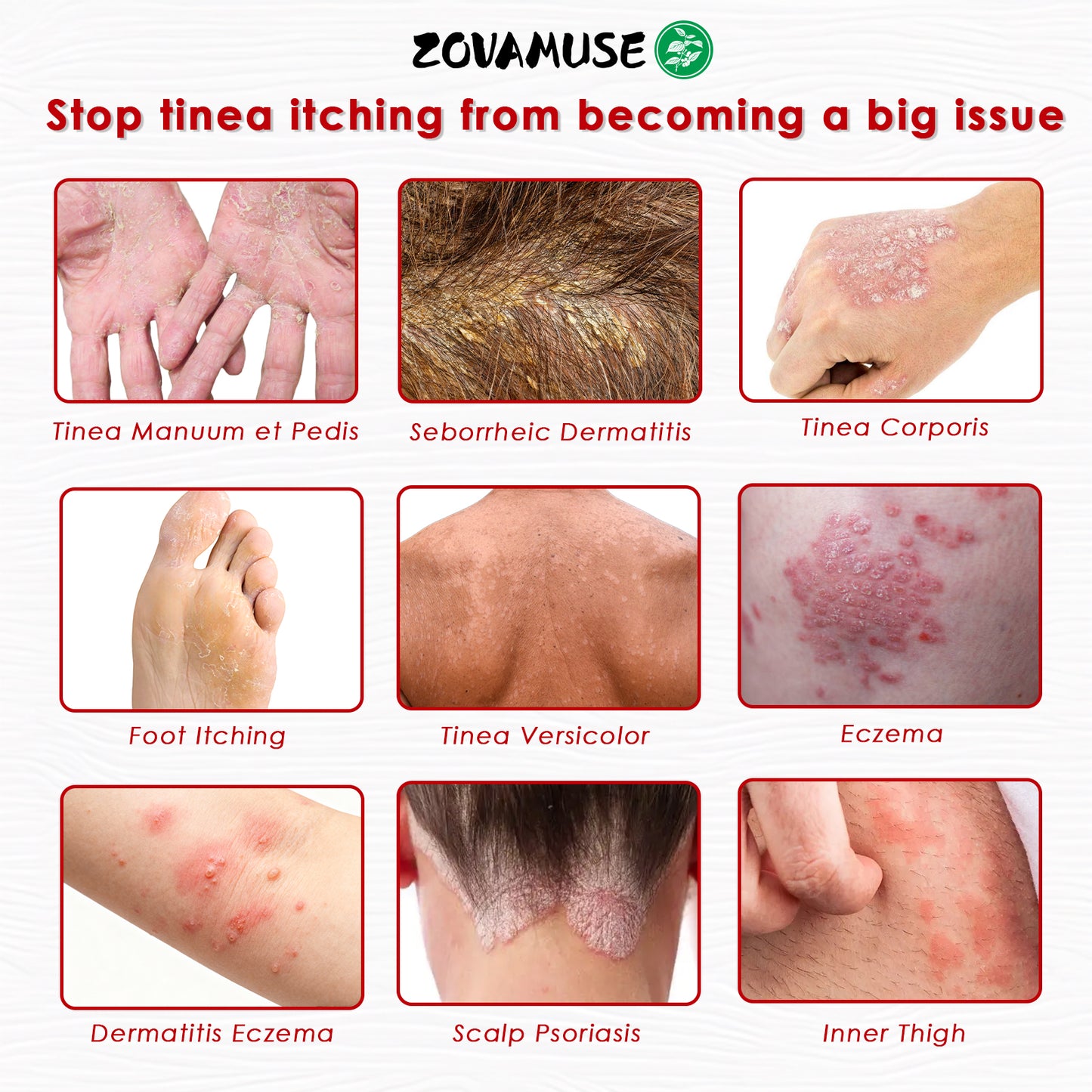 ZovaMuse™ Herbal Miracle Cream