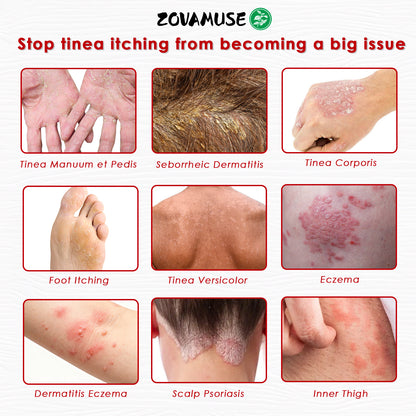 ZovaMuse™ Herbal Miracle Cream