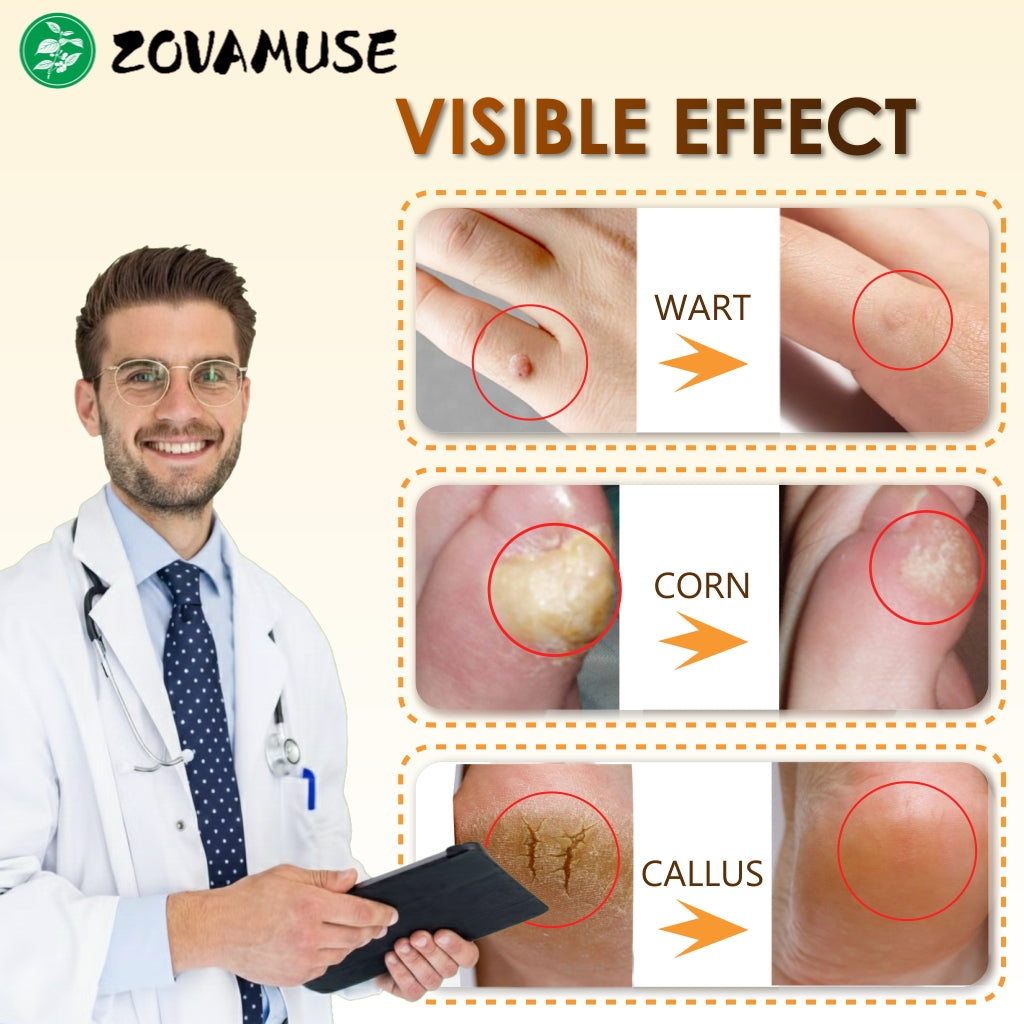 Bee Venom Corn & Callus Cream