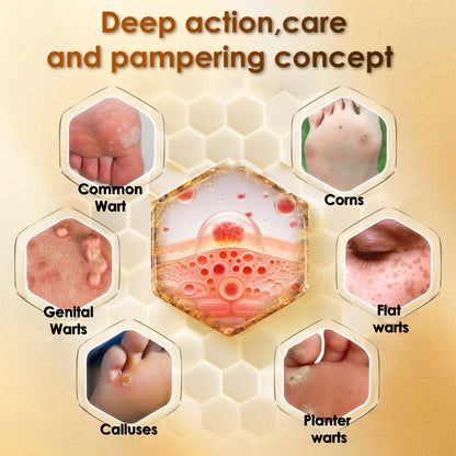 Bee Venom Corn & Callus Cream