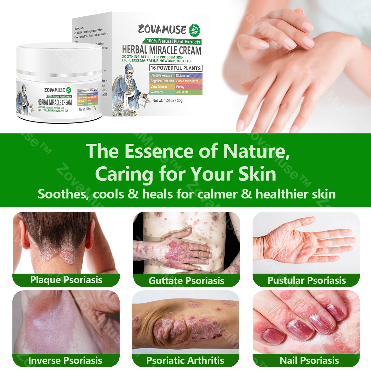 Eczema Relief Cream for Dry, Itchy Skin