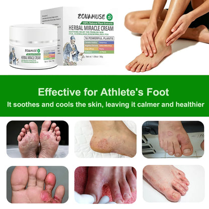 Athlete's Foot Relief Cream for Itchy, Burning Skin