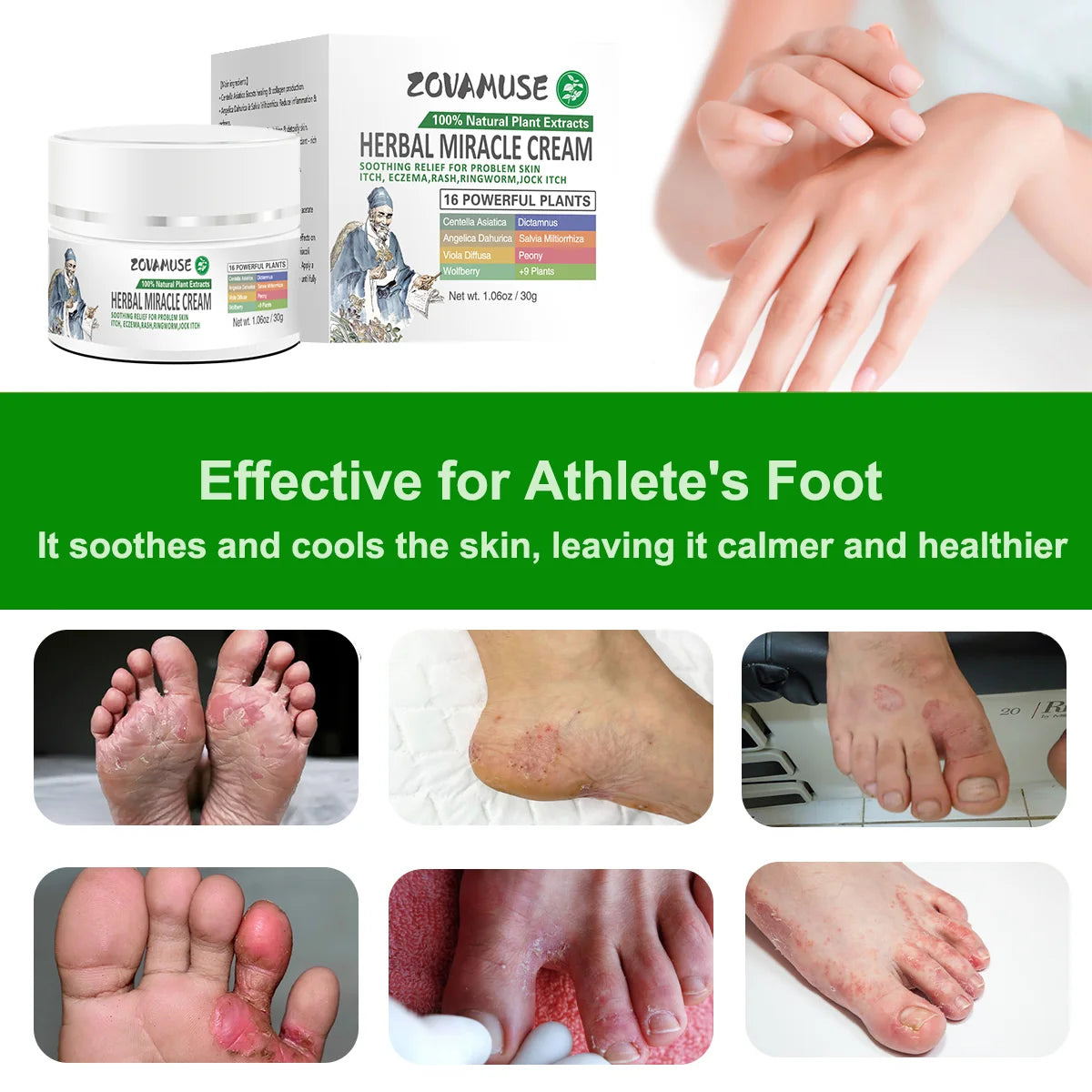 Athlete's Foot Relief Cream for Itchy, Burning Skin