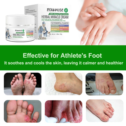 Athlete's Foot Relief Cream for Itchy, Burning Skin