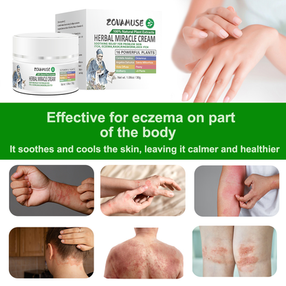 Herbal Miracle Cream for Stubborn Eczema