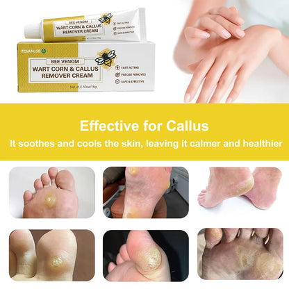 Callus Softening Cream for Dry, Cracked Skin