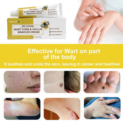 Wart Smoothing Cream for Rough, Thickened Skin