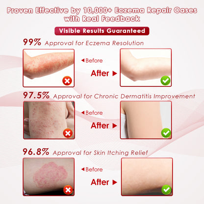 ZovaMuse™ Herbal Miracle Cream