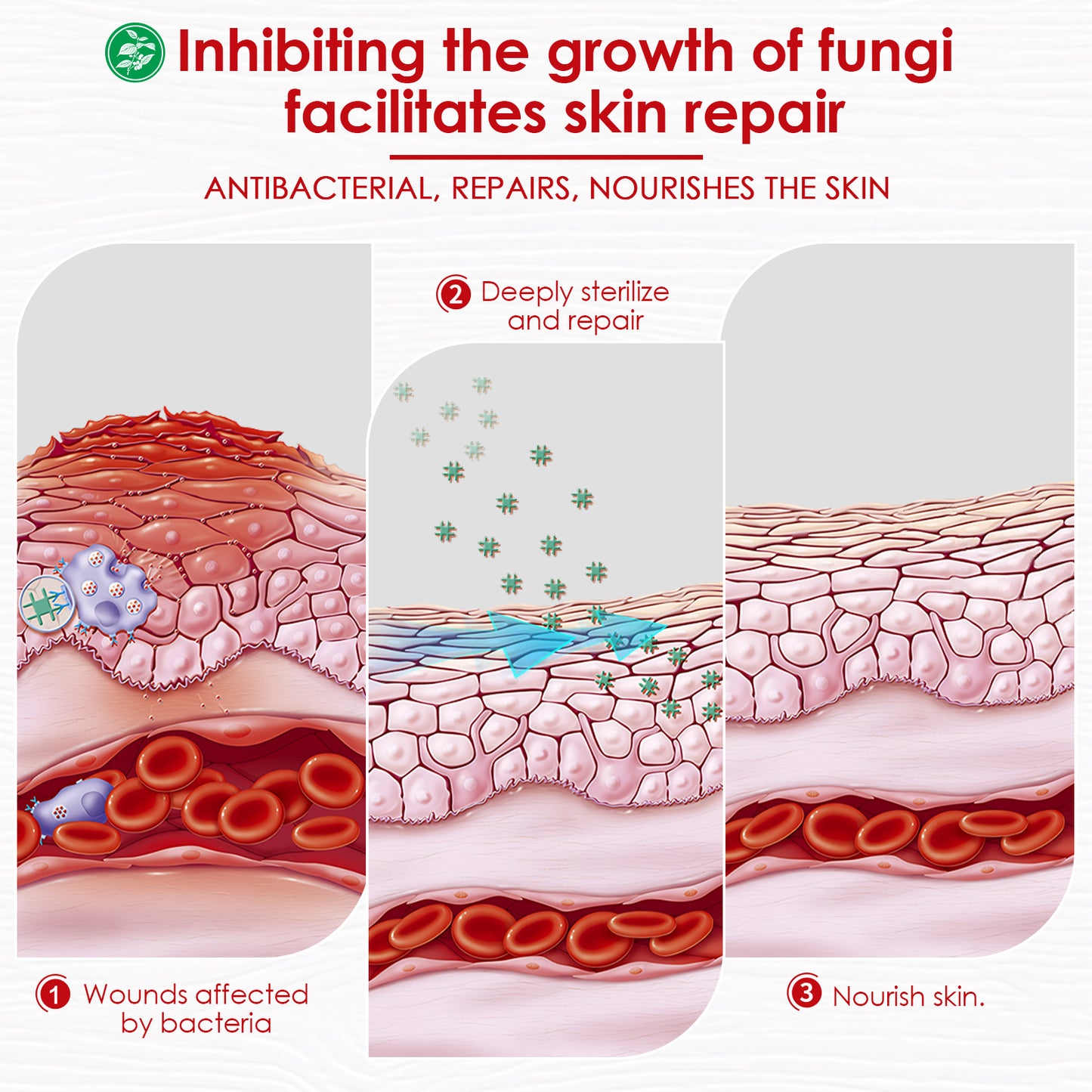 Herbal Miracle Cream for Jock Itch (Tinea Cruris)