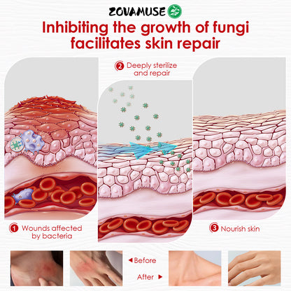 ZovaMuse™ Herbal Miracle Cream